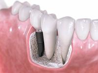 Malvern Endodontics image 2